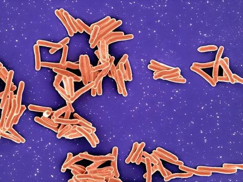  Scanning electron micrograph of Mycobacterium tuberculosis particles (col... Stock Photos