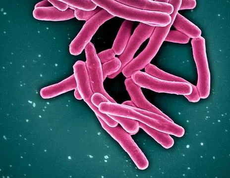  Scanning electron micrograph of Mycobacterium tuberculosis particles (col... Stock Photos