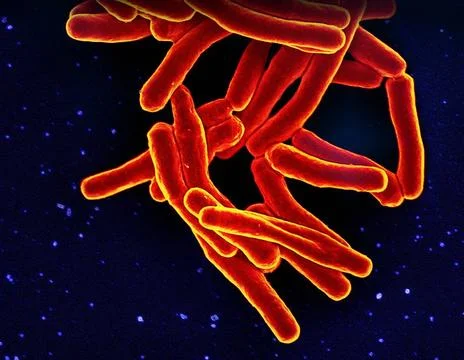  Scanning electron micrograph of Mycobacterium tuberculosis particles (col... Stock Photos