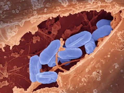  Scanning electron micrograph of Rickettsia typhi bacteria. Rickettsia typ... Stock Photos