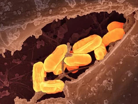  Scanning electron micrograph of Rickettsia typhi bacteria. Rickettsia typ... Stock Photos