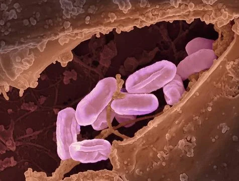  Scanning electron micrograph of Rickettsia typhi bacteria. Rickettsia typ... Stock Photos