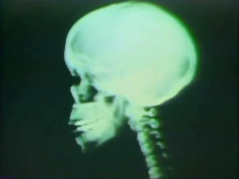 The scanning electron microscope is proven to be a superior scientific Stock Footage 74973915