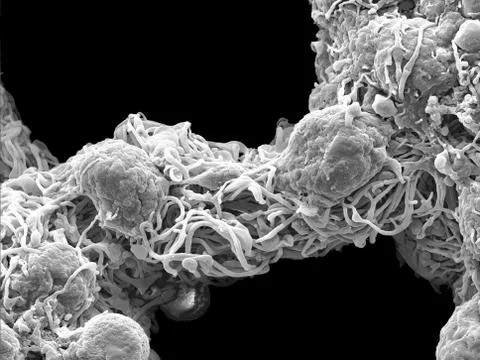 Scanning electron microscopy of the myenteric plexus of a mouse Stock Photos