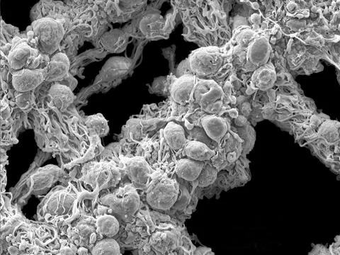 Scanning electron microscopy of the myenteric plexus of a mousepy Stock Photos