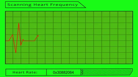 Scanning heart frequency - green screen Stock Footage 34128367
