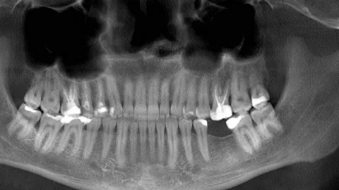 Scanning of the human skull and teeth, x-ray, panorama Stock Footage 169167274