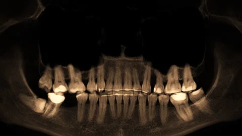 Scanning of the human skull and teeth Stock Footage 276086366
