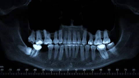 Scanning of the human skull and teeth Stock Footage 276086484