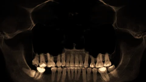 Scanning of the human skull and teeth Stock Footage 276087574