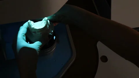 Scanning of the impression of the teeth for further printing on the printer. Stock-Footage 87394107