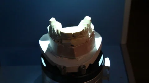 Scanning of the impression of the teeth for further printing on the printer. 库存影片 87394256
