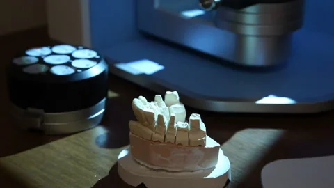 Scanning of the impression of the teeth for further printing on the printer. Stock Footage 87395577
