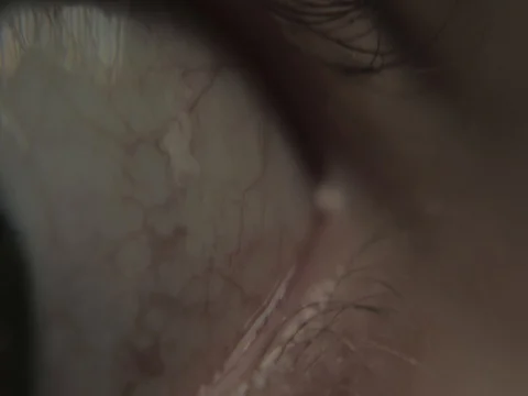 Scared eye Stock Footage 80209344