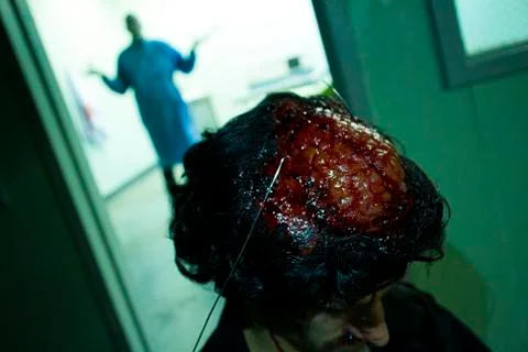 Scary Brain Surgery Experiment Stock Photos