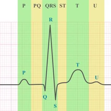 Scheme of ECG on grid paper Ilustración de archivo