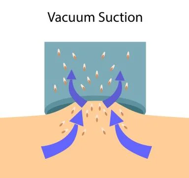 Scheme of Vacuum suction process, vector illustration Stock Illustration