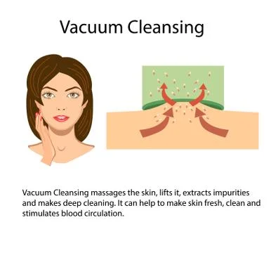 Scheme of Vacuum suction process, vector illustration Stock Illustration