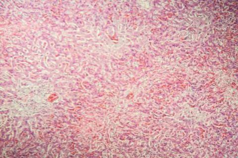 Schockniere Stock Photos