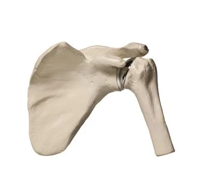 Schoulder replacement Stock Illustration