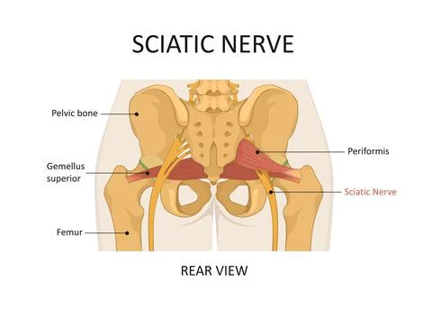 Sciatic nerve. The main causes of sciatica. Stock Illustration