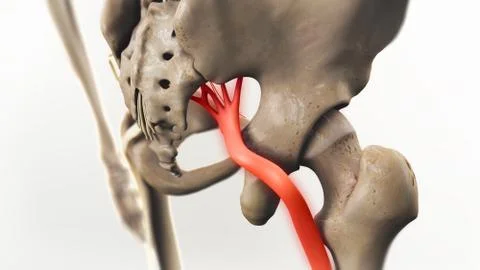 Sciatic Nerve Pain 3D Illustration Stock Illustration