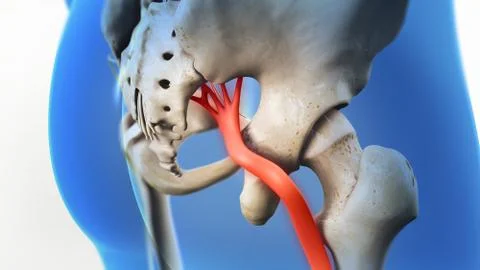 Sciatic Nerve Pain 3D Illustration Stock Illustration