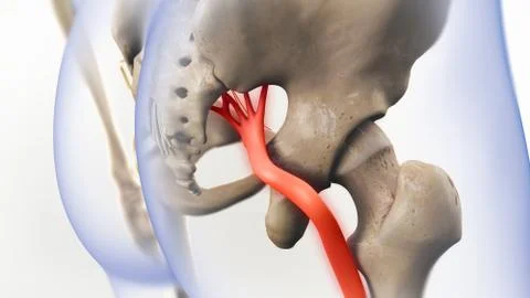 Sciatic Nerve Pain 3D Illustration Stock Illustration