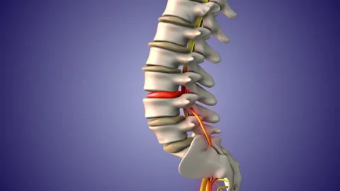 Sciatic nerve pain due to herniated disc Stock Footage 253666421