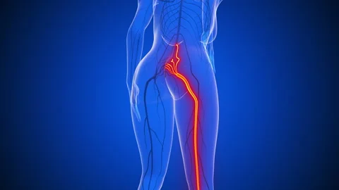 Sciatic nerve pain in the human body Stock Footage 285218242