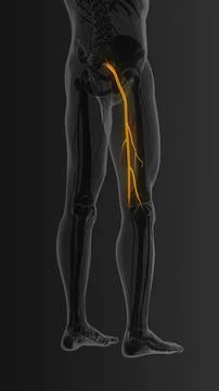 Sciatic nerve pain lower back through hips to leg イラスト素材
