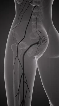Sciatic nerve pain in lower back イラスト素材