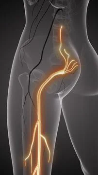 Sciatic nerve pain in lower back Ilustração Stock