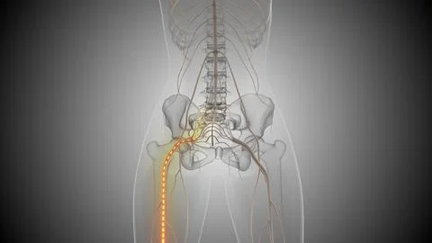 Sciatica causes lower back and leg pain Stock Illustration