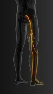 Sciatica nerve pain lower back Stock Illustration