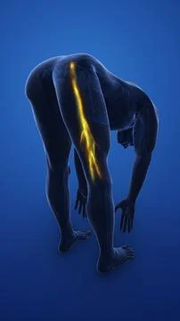 Sciatica Nerve Traveling Hip to Toe Stock Illustration