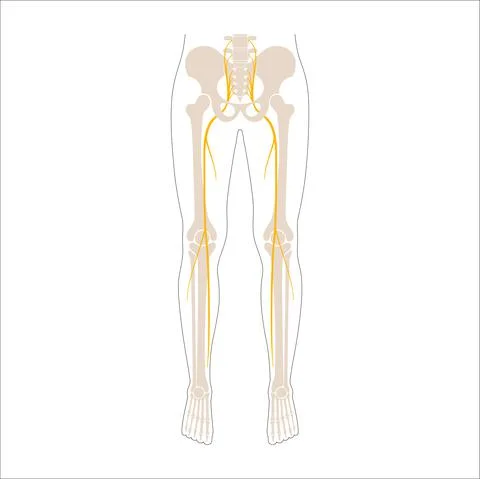Sciatica pain concept Stock Illustration