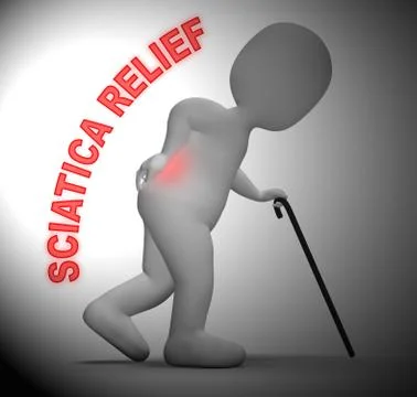 Sciatica Relief Meaning Spinal Pain Easing 3d Rendering Stock Illustration