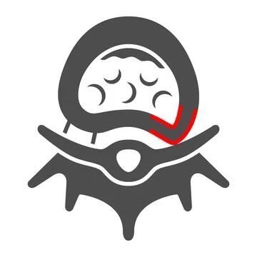 Sciatica solid icon, Human diseases concept, Sciatica Back Pain sign on white Stock Illustration