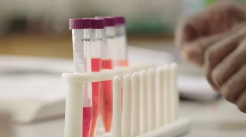 Science Test Tube Hand Opens HD Vídeos de archivo 61245210