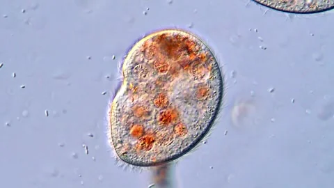 Scientific Close-Up of Microscopic Ciliate Organisms (400x) 動画素材 318946277