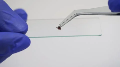 Scientific researcher handling tiny tick specimen, using precise tweezers while Stock Footage 310428424