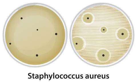 Scientific vector illustration of Staphylococcus aureus bacterial colonies an Illustrazione stock