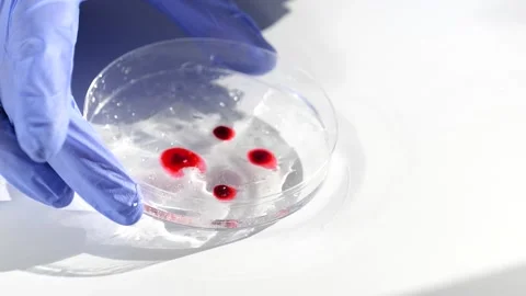 Scientist adding blood sample on petri dish Stock Footage 149371081