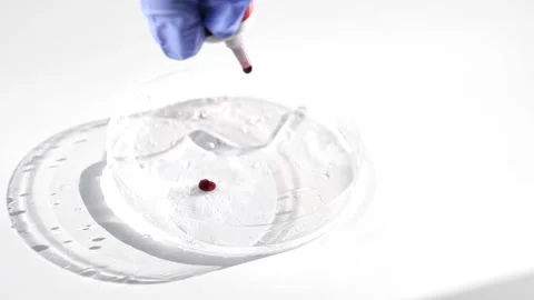 Scientist adding blood sample on petri dish Stock Footage 149400959