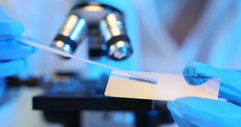 Scientist analyzes smear sample using glass microscope Stock Footage 274189714