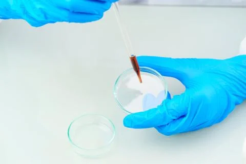 Scientist analyzing a blood sample on tray in laboratory Stock Photos