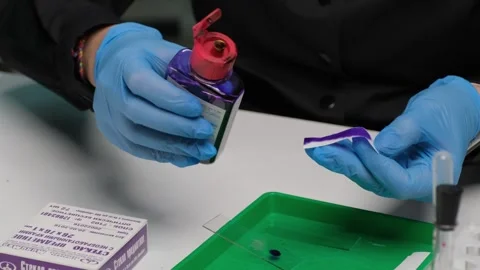 Scientist Applying Reagent to Sample Stock Footage 302888959