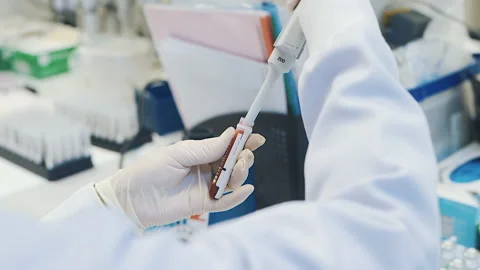 Scientist collect some blood sample from bottle slow motion Video stock 158527063