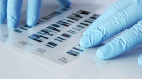 Scientist compares DNA profiles, 4k, UHD Stock Footage 49168315